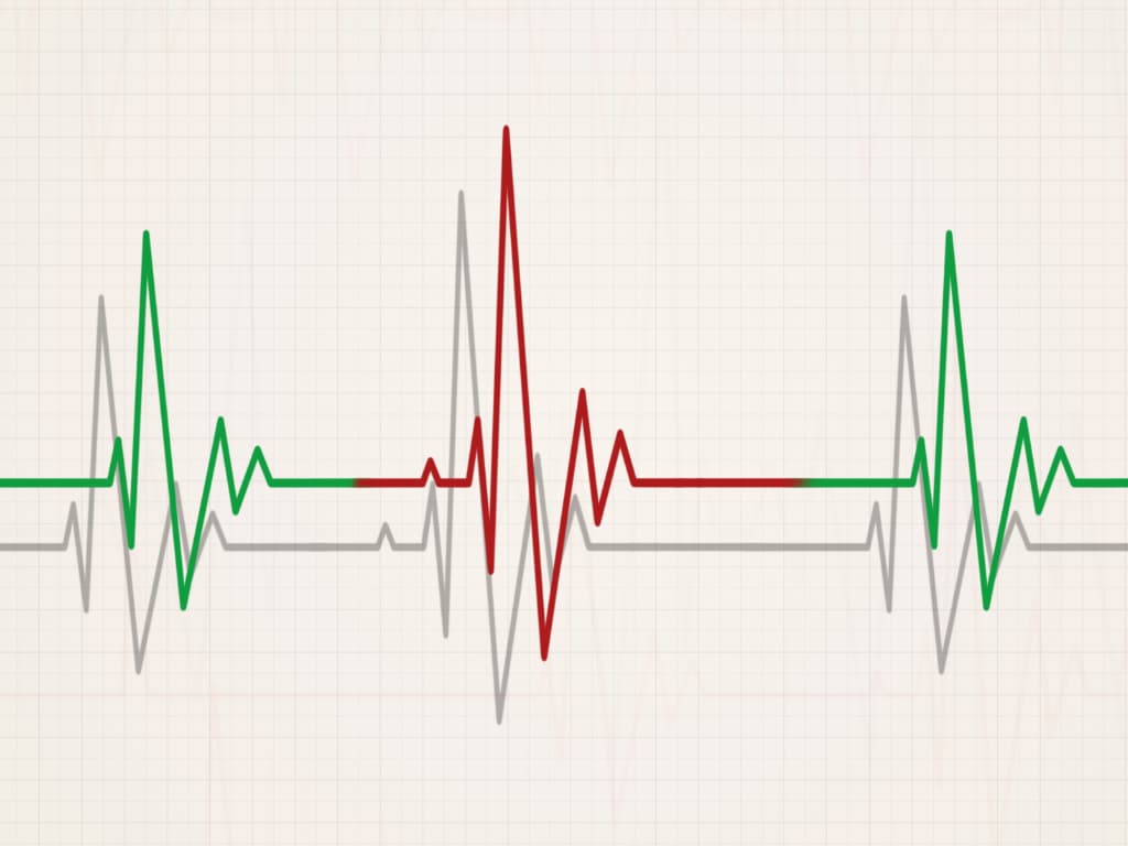 tegenkomen Koreaans pad Onregelmatige hartslag - Bloeddrukmeter.shop